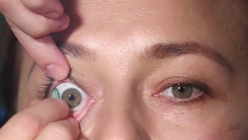 Инородное тело в глазу. помощь при попадании и удаление инородного тела из глаза